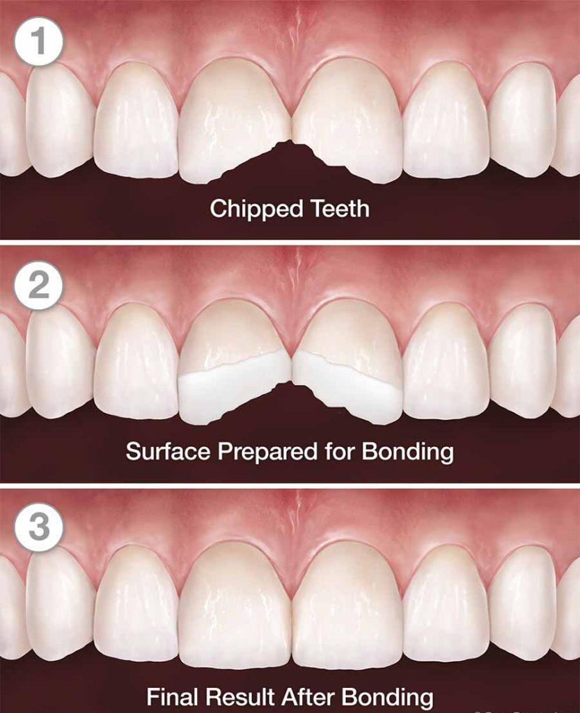 Cosmetic-Dentist