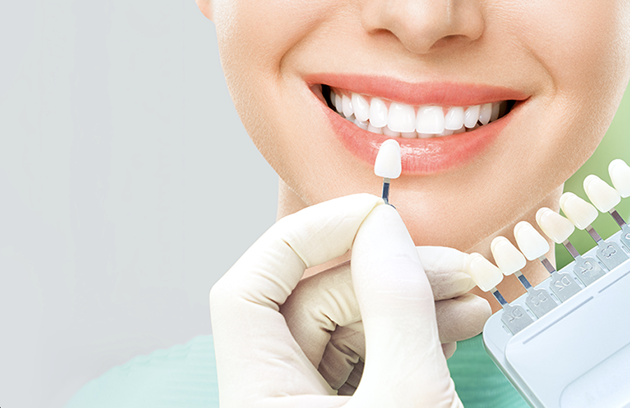 Non-Surgical-Dental-Treatments