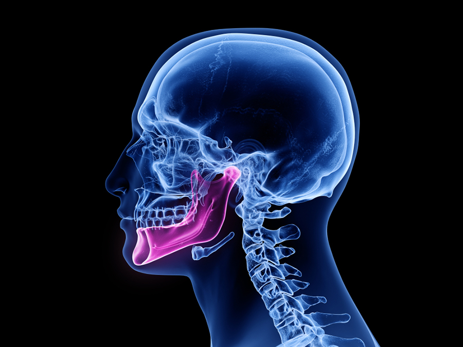 TMJ-Disorders