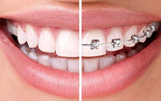 invisalign-dentist