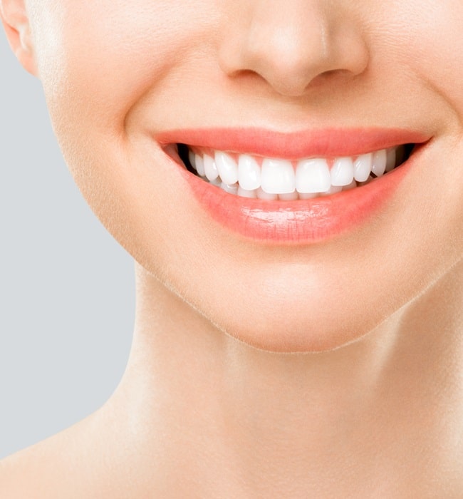 teeth-whitening-Queens