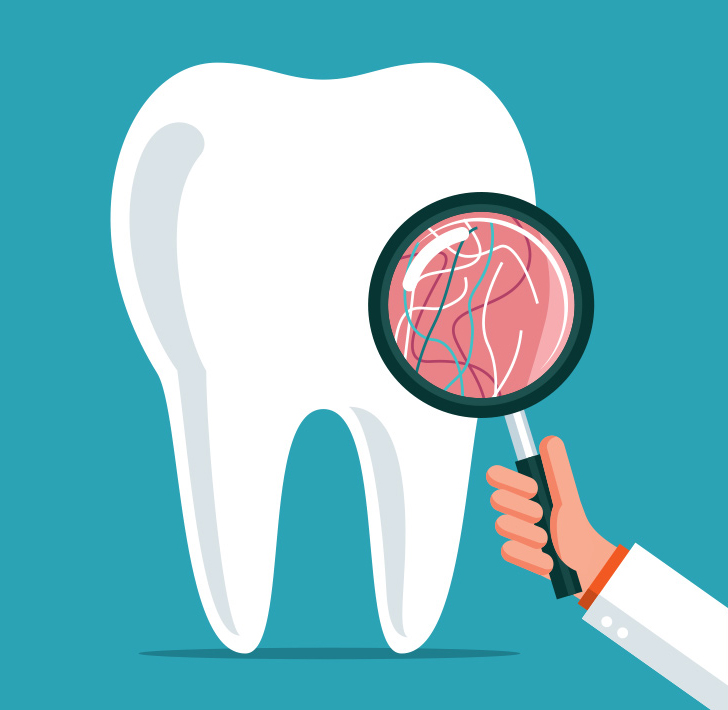dental-insurance-coverage-for-root-canals