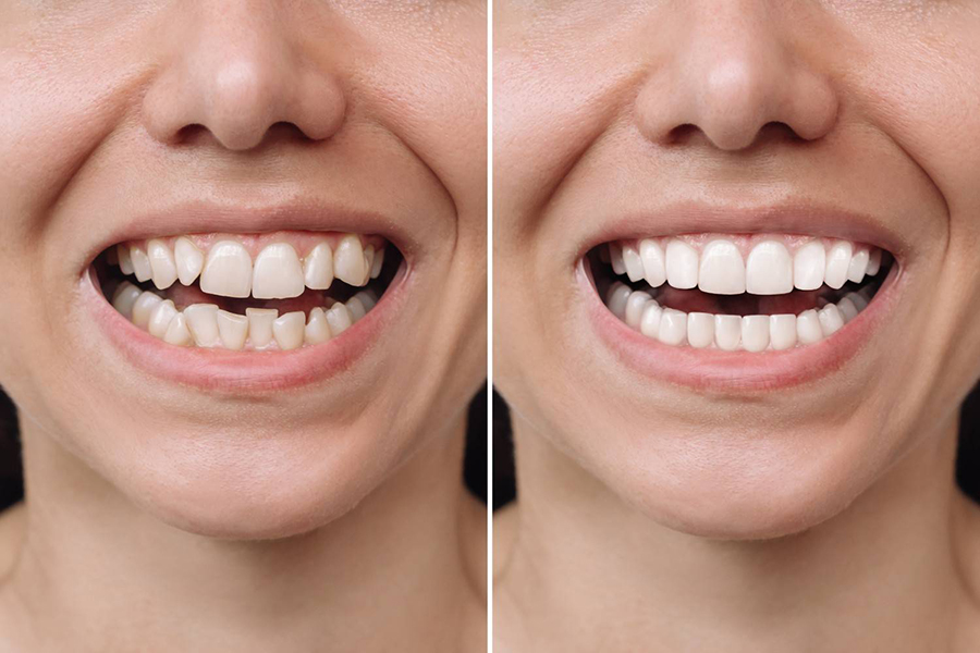 smile-make-over-dentist